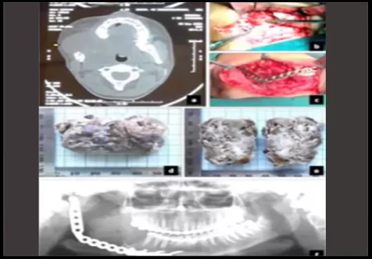 saraswati dental college