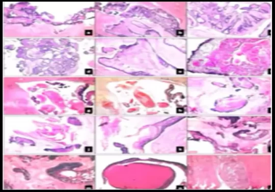 saraswati dental college