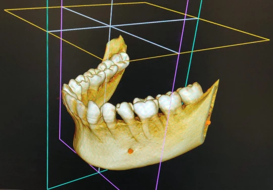 saraswati dental college