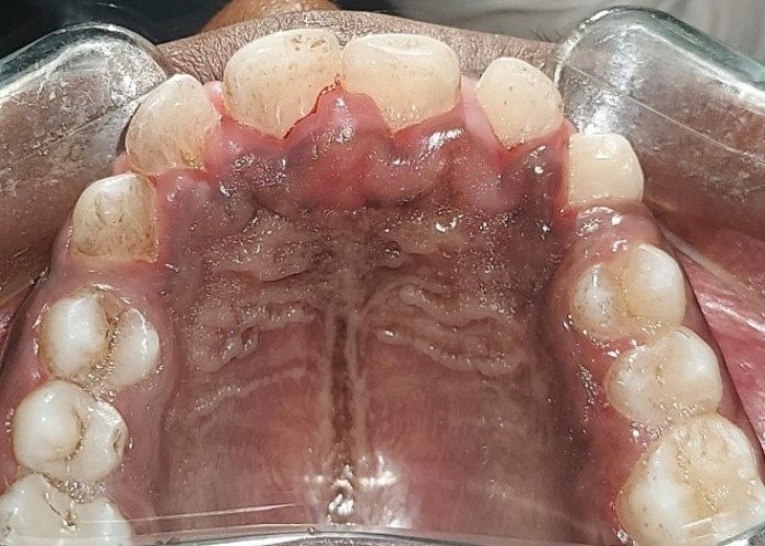 saraswati dental college