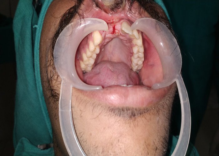 saraswati dental college