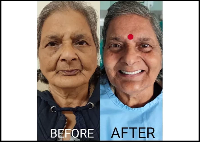 saraswati dental college