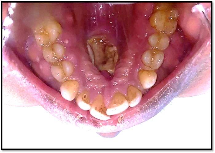 saraswati dental college