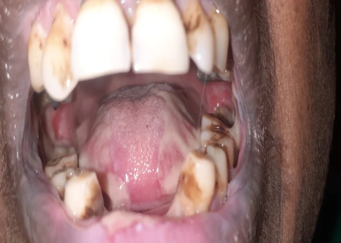 saraswati dental college