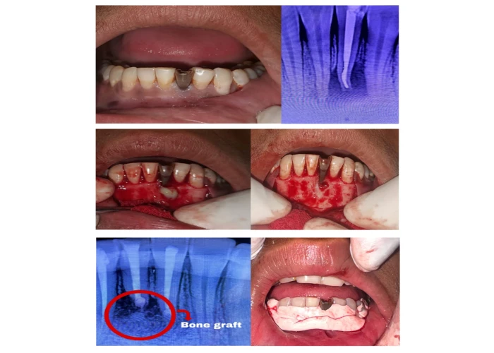 saraswati dental college