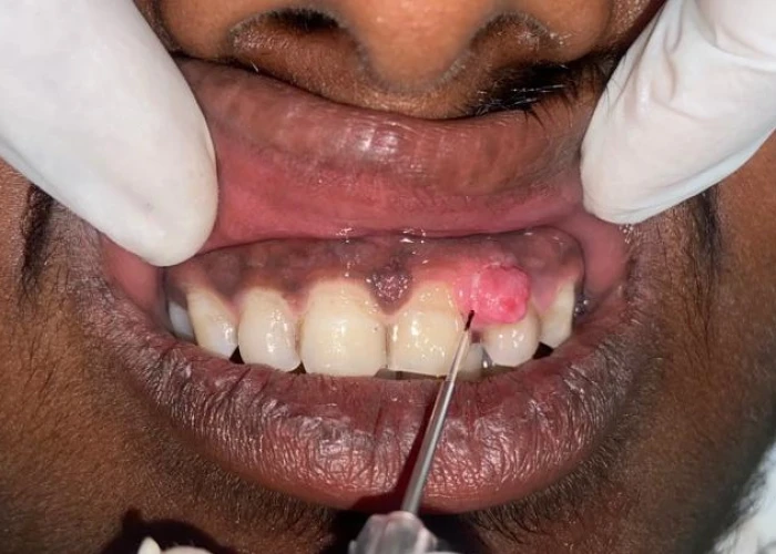 saraswati dental college