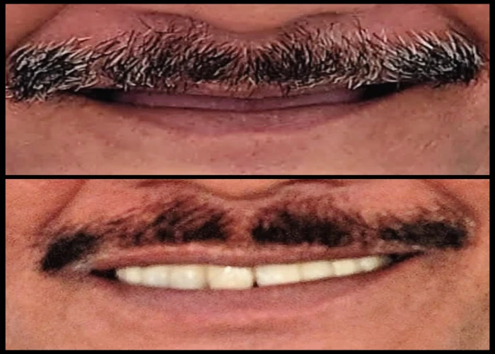 saraswati dental college