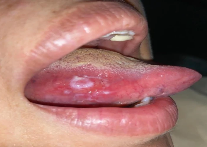 saraswati dental college