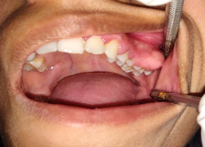 saraswati dental college