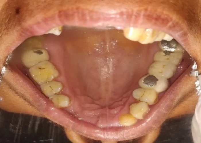 saraswati dental college