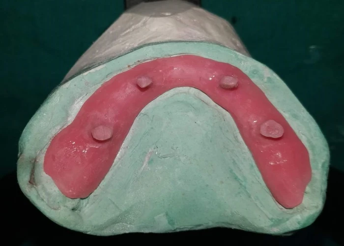 saraswati dental college