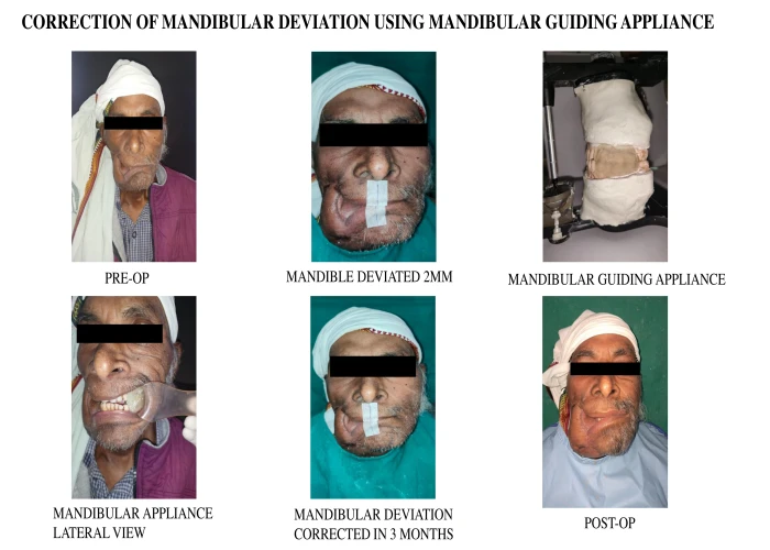 saraswati dental college