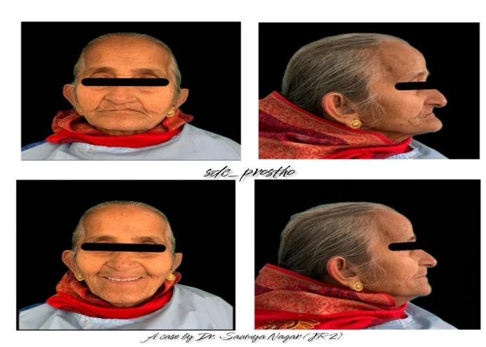 saraswati dental college