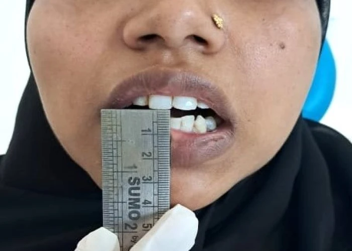 saraswati dental college