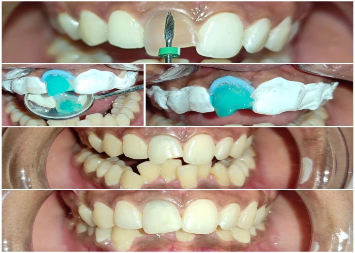saraswati dental college