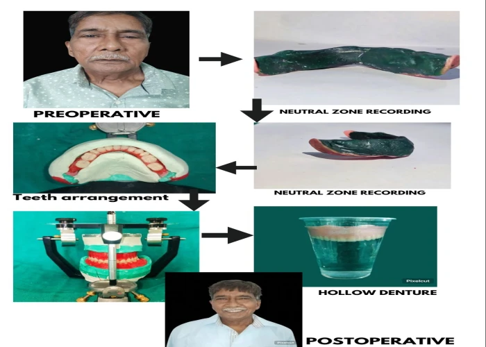 saraswati dental college