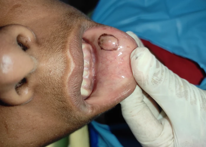 saraswati dental college