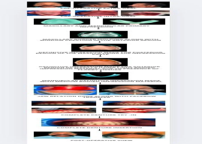 saraswati dental college