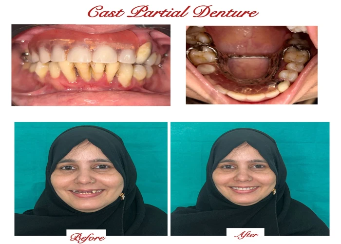 saraswati dental college