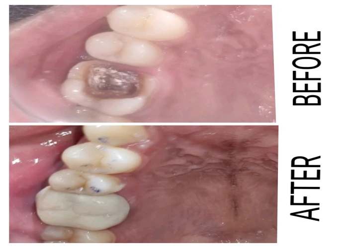 saraswati dental college