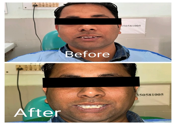 saraswati dental college