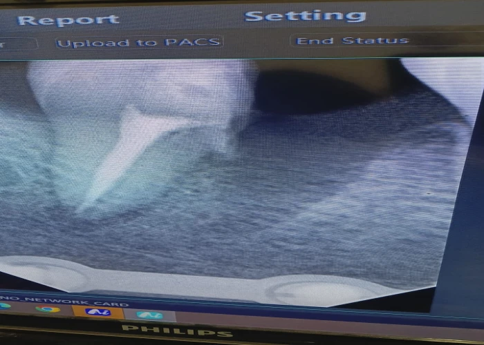 saraswati dental college