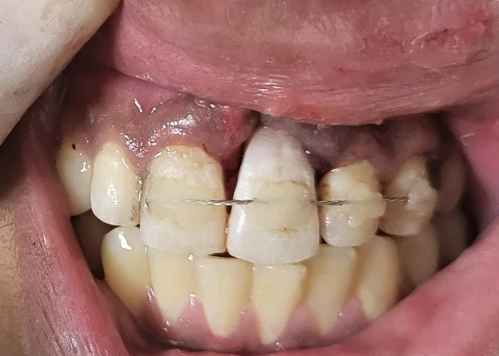 saraswati dental college