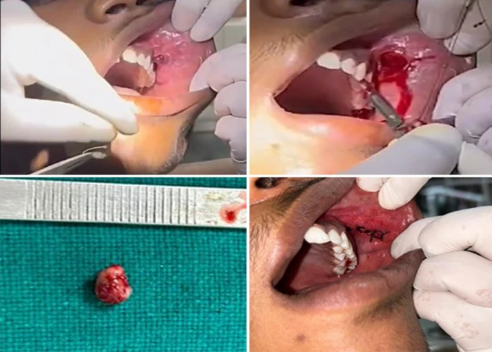 saraswati dental college