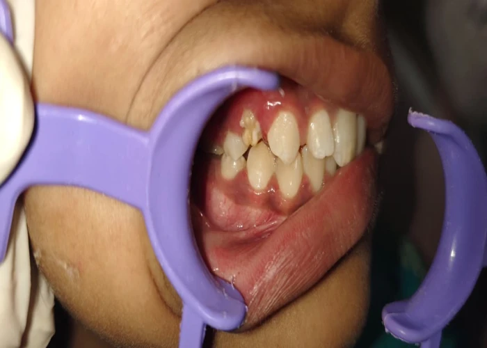 saraswati dental college