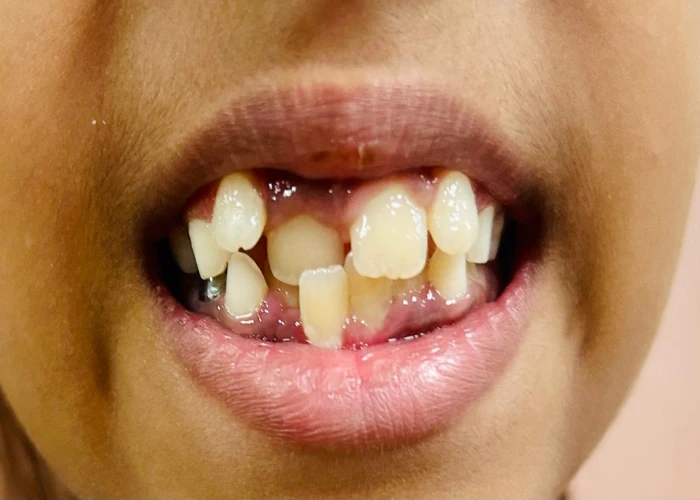 saraswati dental college