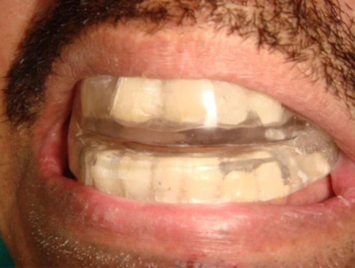 saraswati dental college