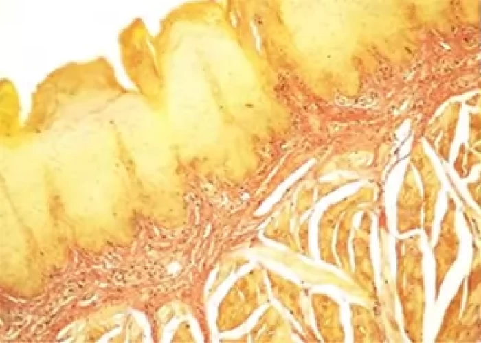 saraswati dental college