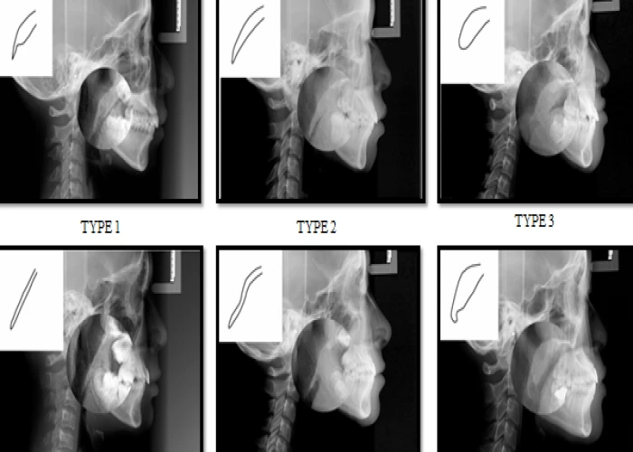 saraswati dental college