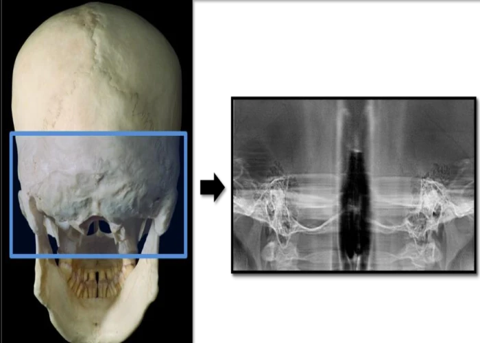 saraswati dental college
