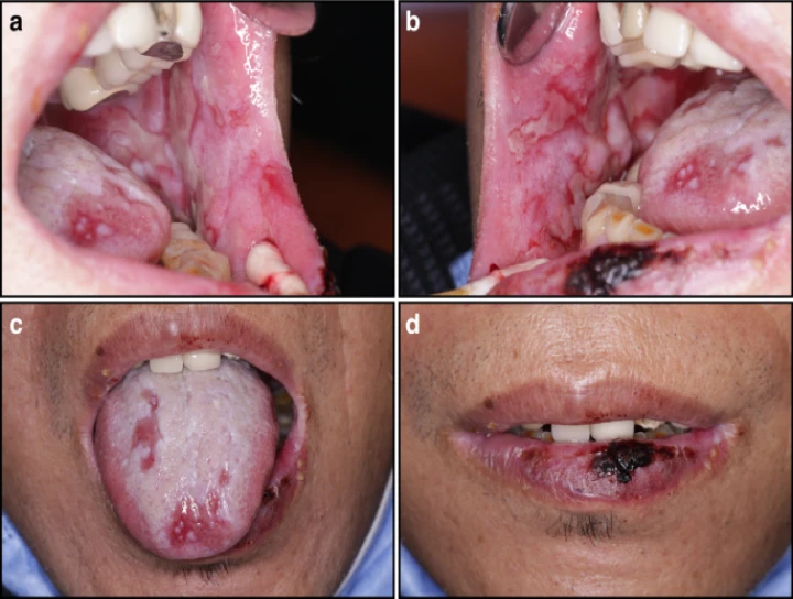 saraswati dental college