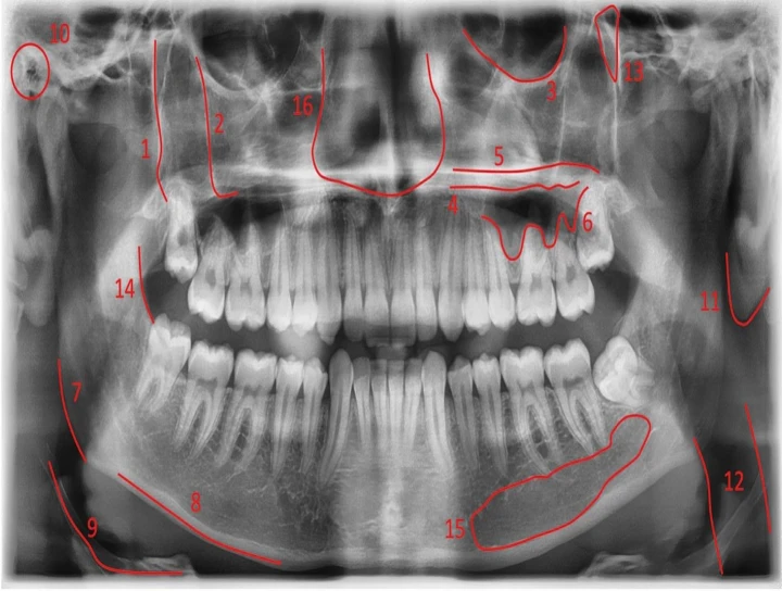 saraswati dental college