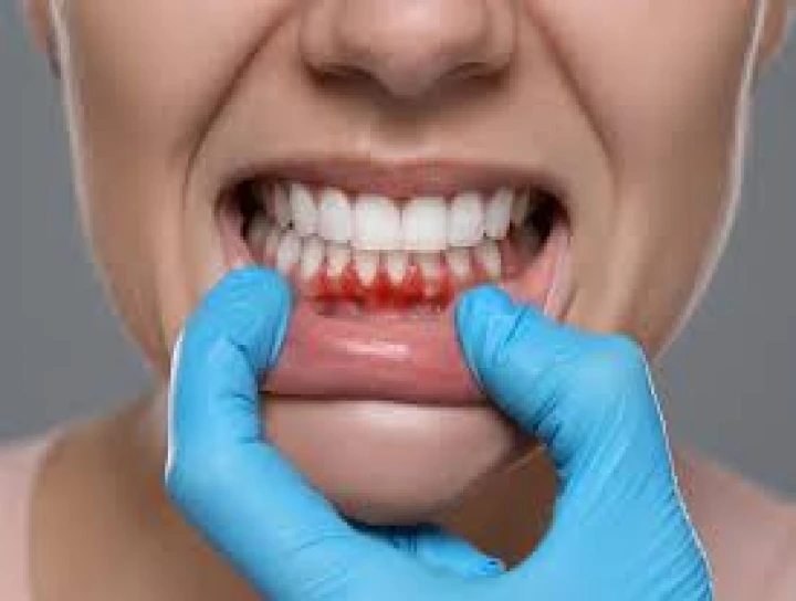 saraswati dental college