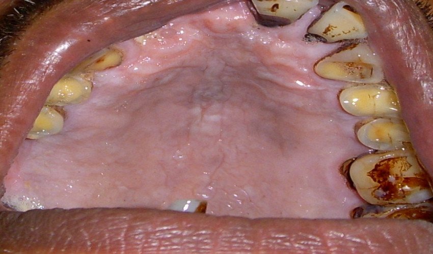 saraswati dental college