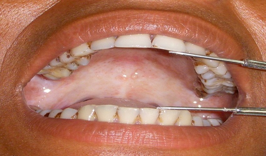 saraswati dental college