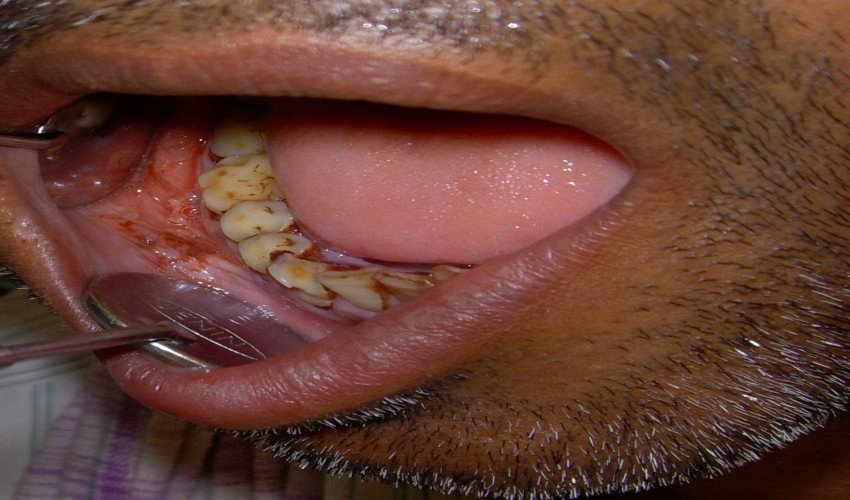 saraswati dental college