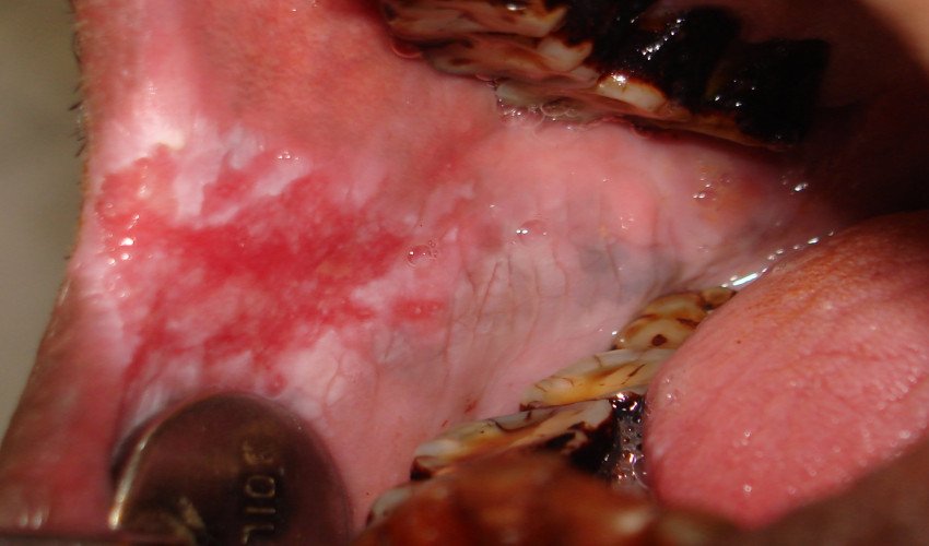 saraswati dental college