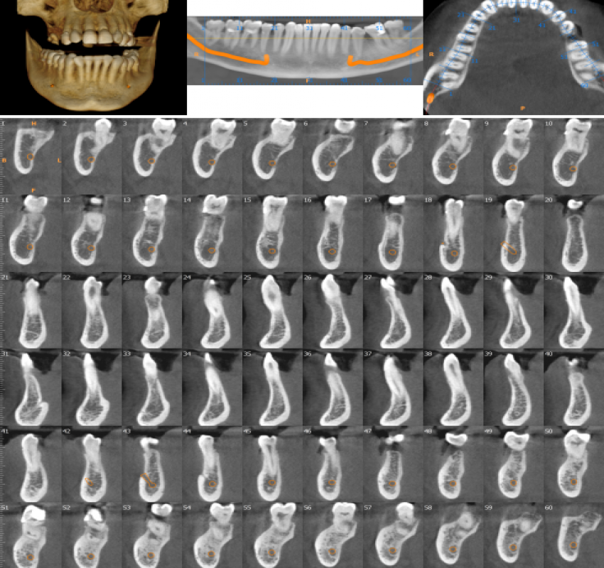 saraswati dental college