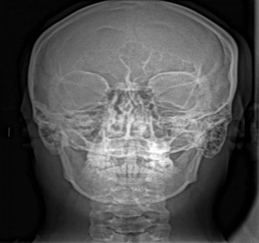 saraswati dental college