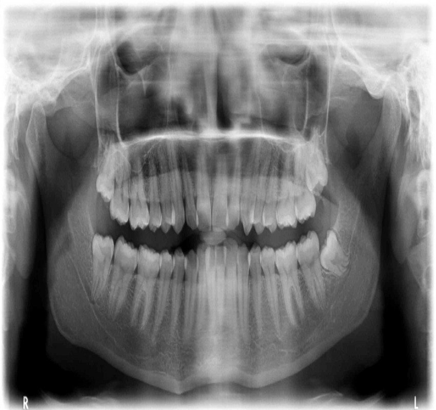 saraswati dental college