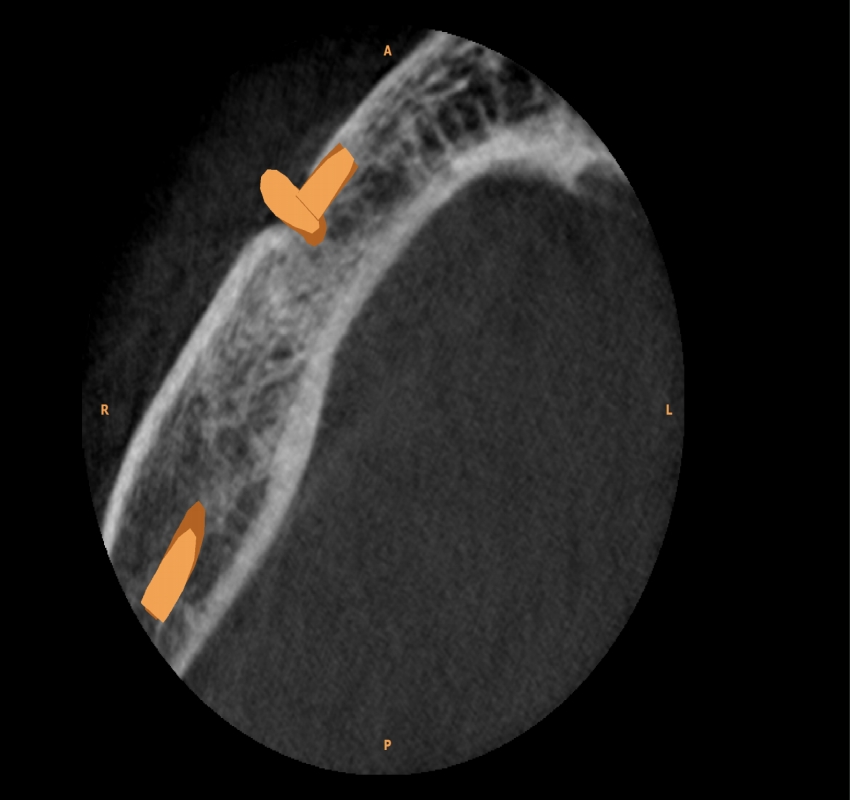 saraswati dental college