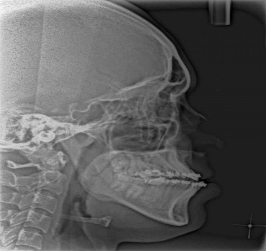 saraswati dental college