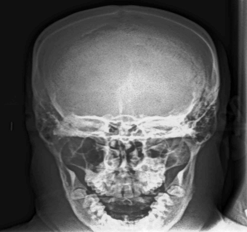 saraswati dental college