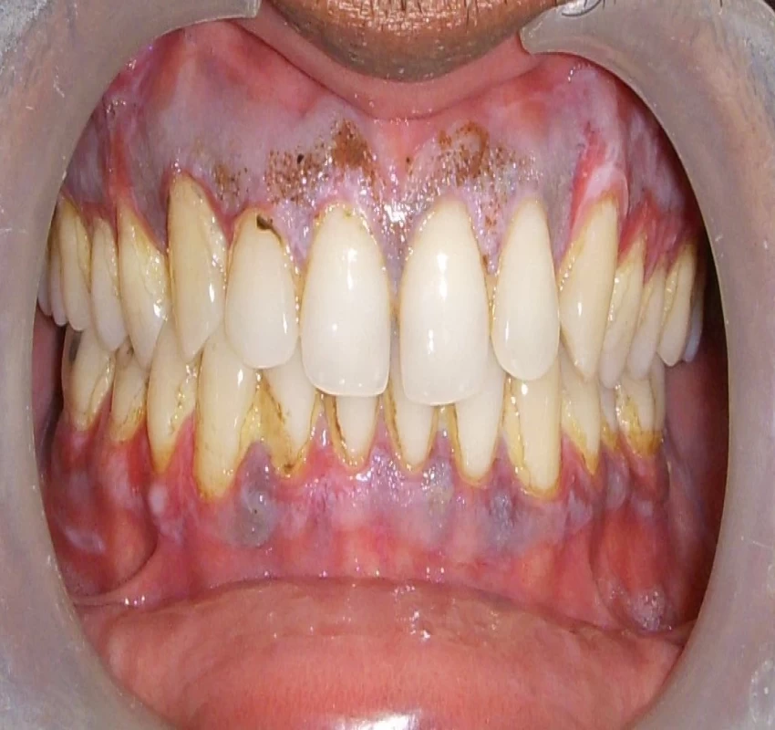 saraswati dental college