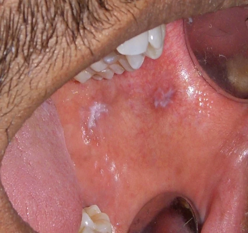 saraswati dental college