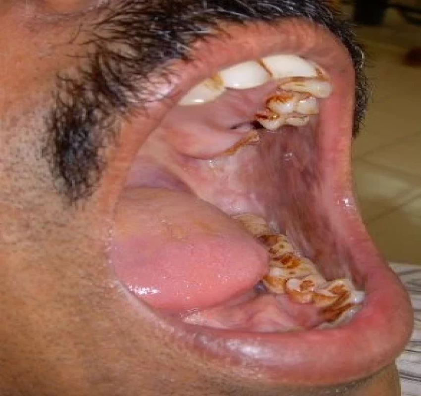 saraswati dental college